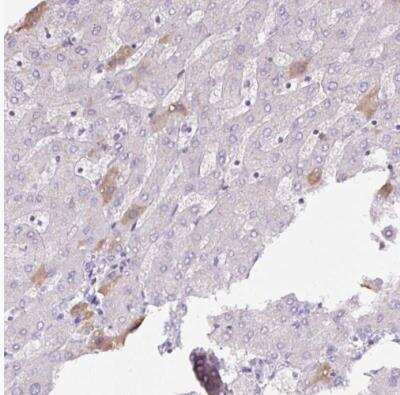 Immunohistochemistry-Paraffin: Apolipoprotein A-I/ApoA1 Antibody [NBP2-33468]