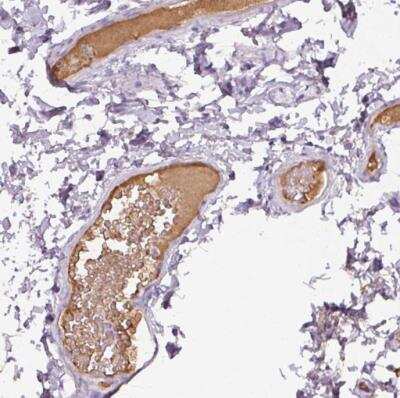 Immunohistochemistry-Paraffin: Apolipoprotein A-I/ApoA1 Antibody [NBP2-33468]