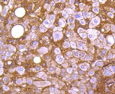 Immunohistochemistry-Paraffin: Apolipoprotein A-I/ApoA1 Antibody (JF0548) [NBP2-67161]