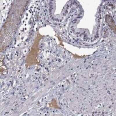 Immunohistochemistry-Paraffin: Apolipoprotein A-II/ApoA2 Antibody [NBP3-17684]