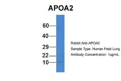 Western Blot: Apolipoprotein A-II/ApoA2 Antibody [NBP1-57716]