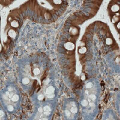 Immunohistochemistry: Apolipoprotein A-IV/ApoA4 Antibody (CL0465) [NBP2-52930]
