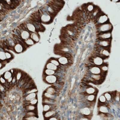 Immunohistochemistry-Paraffin: Apolipoprotein A-IV/ApoA4 Antibody (CL0465) [NBP2-52930]