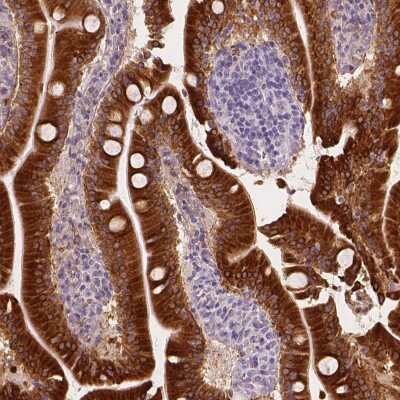 Immunohistochemistry-Paraffin: Apolipoprotein A-IV/ApoA4 Antibody [NBP1-86164]