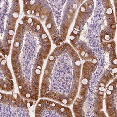 Immunohistochemistry-Paraffin: Apolipoprotein A-IV/ApoA4 Antibody [NBP1-86179]