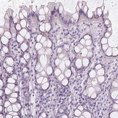 Immunohistochemistry-Paraffin: Apolipoprotein A-IV/ApoA4 Antibody [NBP1-86179]