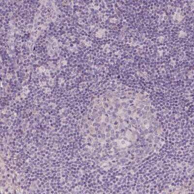 Immunohistochemistry-Paraffin: Apolipoprotein A-IV/ApoA4 Antibody [NBP1-86179]