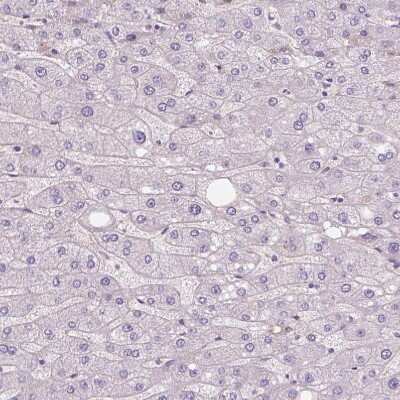 Immunohistochemistry-Paraffin: Apolipoprotein A-IV/ApoA4 Antibody [NBP1-86179]