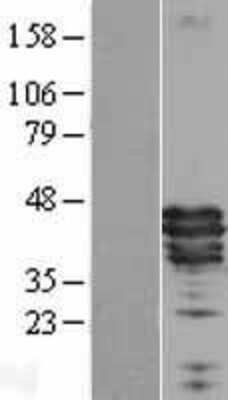 Western Blot: Apolipoprotein A5 Overexpression Lysate [NBL1-07611]