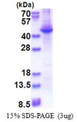 SDS-PAGE: Recombinant Human Apolipoprotein A5 His Protein [NBP2-22689]