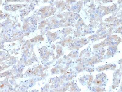 Immunohistochemistry-Paraffin: Apolipoprotein B/ApoB Antibody (APOB/3300) [NBP3-07230]