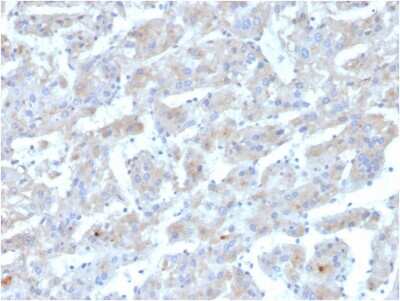 Immunohistochemistry-Paraffin: Apolipoprotein B/ApoB Antibody (APOB/3300) - Azide and BSA Free [NBP3-08226]