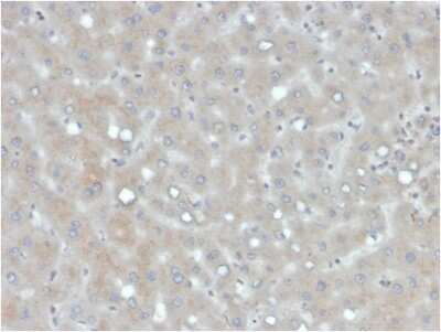 Immunohistochemistry-Paraffin: Apolipoprotein B/ApoB Antibody (APOB/4333) [NBP3-07231]