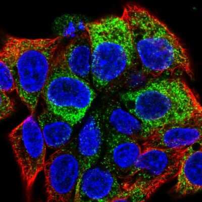 Immunocytochemistry/ Immunofluorescence: Apolipoprotein B/ApoB Antibody [NBP2-38608]