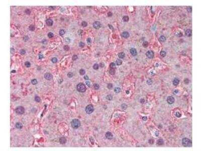 Immunohistochemistry-Paraffin: Apolipoprotein B/ApoB Antibody [NB120-7616]