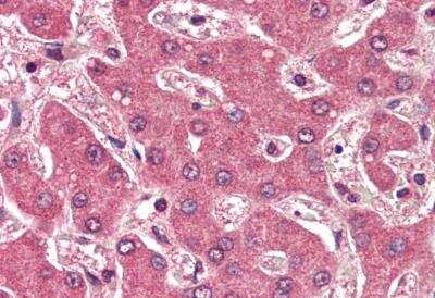 Immunohistochemistry-Paraffin: Apolipoprotein B/ApoB Antibody [NBP1-20878]