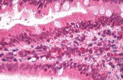 Immunohistochemistry-Paraffin: Apolipoprotein B/ApoB Antibody [NBP1-20878]