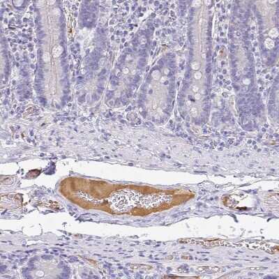 Immunohistochemistry-Paraffin: Apolipoprotein B/ApoB Antibody [NBP2-38608]
