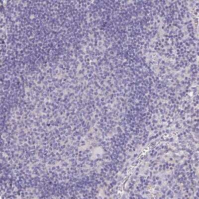 Immunohistochemistry-Paraffin: Apolipoprotein B/ApoB Antibody [NBP2-38608]