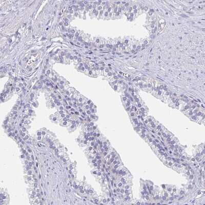 Immunohistochemistry-Paraffin: Apolipoprotein B/ApoB Antibody [NBP2-38608]