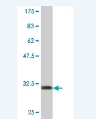 Western Blot: Apolipoprotein C-II/ApoC2 Antibody (3E4) [H00000344-M01]