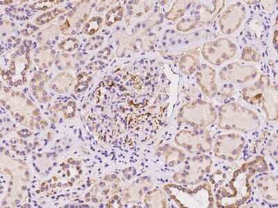 Immunohistochemistry-Paraffin: Apolipoprotein C-II/ApoC2 Antibody [NBP2-97375]