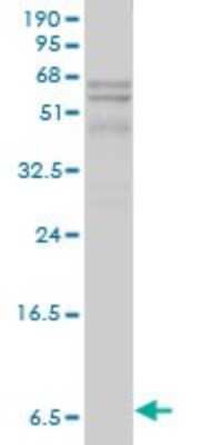 Western Blot: Apolipoprotein C1 Antibody (2E2-1A3) [H00000341-M01]
