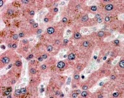 Immunohistochemistry-Paraffin: Apolipoprotein C1 Antibody [NBP1-06016]