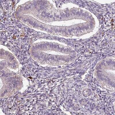 Immunohistochemistry-Paraffin: Apolipoprotein C1 Antibody [NBP2-49010]