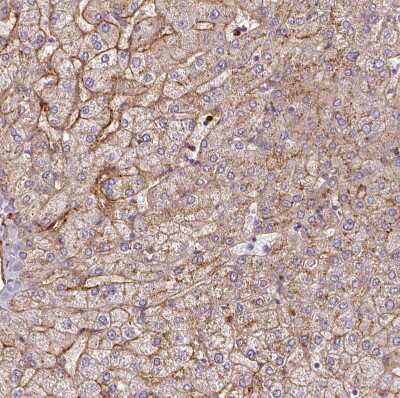 Immunohistochemistry-Paraffin: Apolipoprotein C1 Antibody [NBP2-49010]