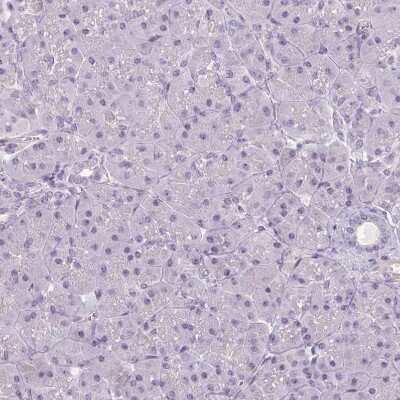 Immunohistochemistry-Paraffin: Apolipoprotein C1 Antibody [NBP2-49010]