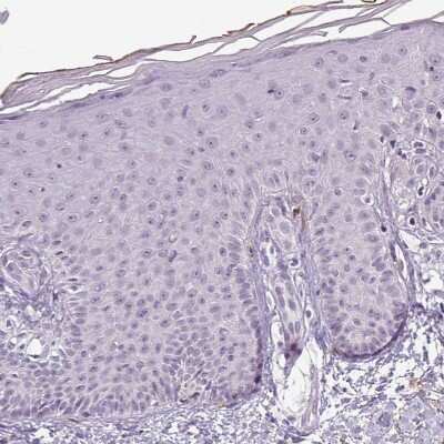 Immunohistochemistry-Paraffin: Apolipoprotein C1 Antibody [NBP2-49010]