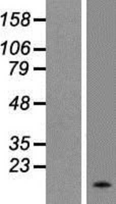 Western Blot: Apolipoprotein C-II/ApoC2 Overexpression Lysate [NBP2-10673]