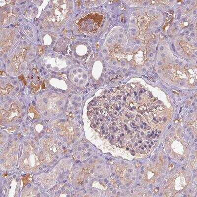 Immunohistochemistry: Apolipoprotein C4 Antibody [NBP2-46869]