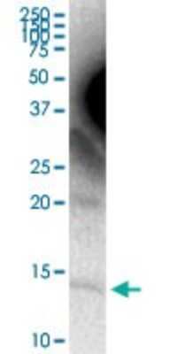 Western Blot: Apolipoprotein C4 Antibody [H00000346-D01P]