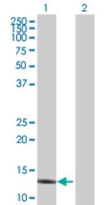 Western Blot: Apolipoprotein C4 Antibody [H00000346-D01P]