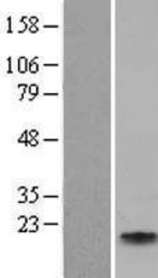 Western Blot: Apolipoprotein C4 Overexpression Lysate [NBP2-04200]