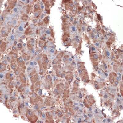 Immunohistochemistry-Paraffin: Apolipoprotein CIII Antibody (3T7Y5) [NBP3-16093]