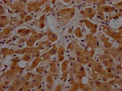 Immunohistochemistry: Apolipoprotein CIII Antibody (8H12) [NBP3-15194]