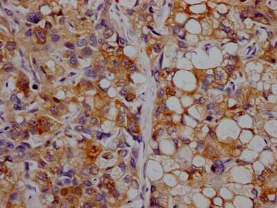 Immunohistochemistry: Apolipoprotein CIII Antibody (8H12) [NBP3-15194]