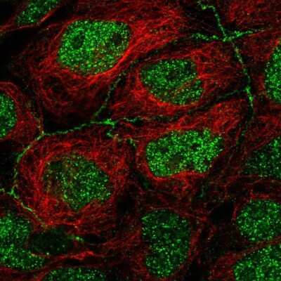 Immunocytochemistry/ Immunofluorescence: Apolipoprotein CIII Antibody [NBP2-68831]