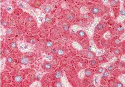 Immunohistochemistry-Paraffin: Apolipoprotein CIII Antibody [NB600-610]