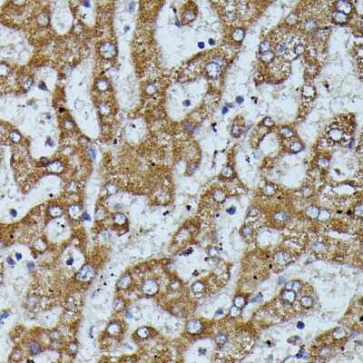 Immunohistochemistry-Paraffin: Apolipoprotein CIII Antibody - Azide and BSA Free [NBP2-92734]