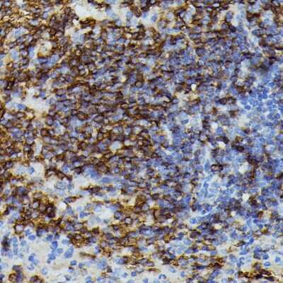 Immunohistochemistry-Paraffin: Apolipoprotein CIII Antibody - Azide and BSA Free [NBP2-92734]