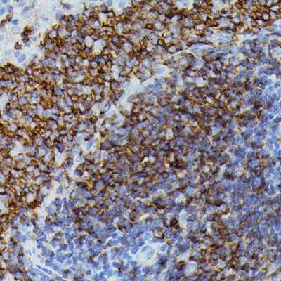 Immunohistochemistry-Paraffin: Apolipoprotein CIII Antibody - Azide and BSA Free [NBP2-92734]