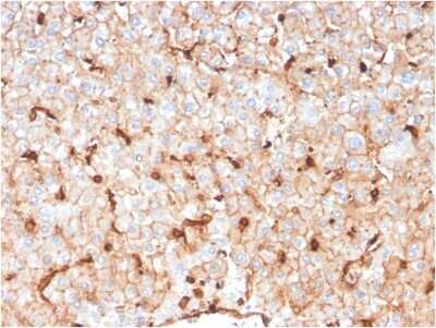 Immunohistochemistry-Paraffin: Apolipoprotein D Antibody (APOD/3414) - Azide and BSA Free [NBP3-08437]