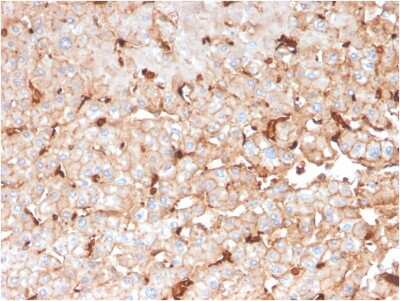 Immunohistochemistry-Paraffin: Apolipoprotein D Antibody (APOD/3414) - Azide and BSA Free [NBP3-08437]