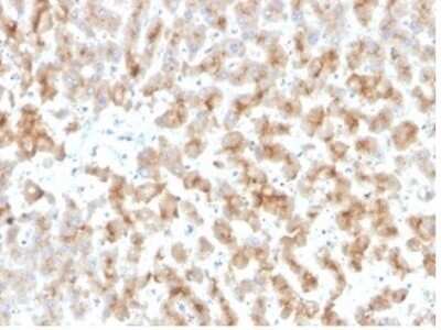 Immunohistochemistry-Paraffin: Apolipoprotein D Antibody (APOD/3415) [NBP3-13947]