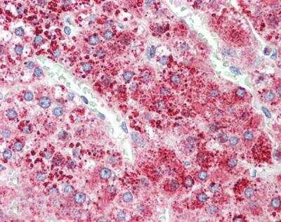 Immunohistochemistry: Apolipoprotein D Antibody [NBP2-42512]