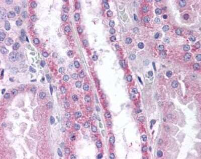 Immunohistochemistry-Paraffin: Apolipoprotein D Antibody [NBP1-40025]